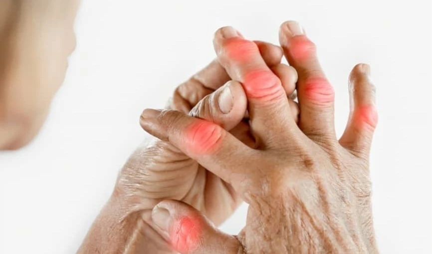 Cerca de 18 millones de personas sufren artritis reumatoide