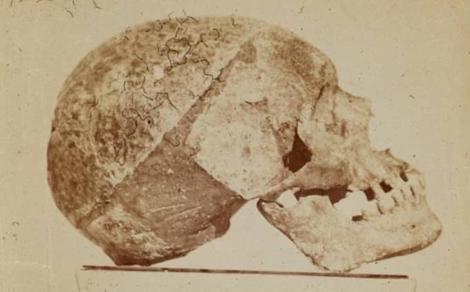 El cráneo de Beethoven guió la aproximación facial. Foto: Pen News.