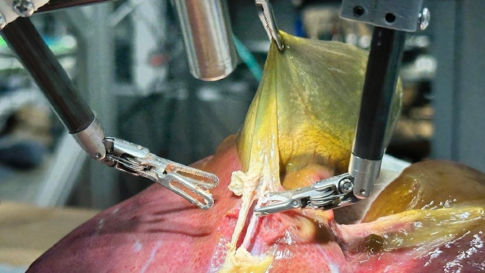 El robot quirúrgico SRT-H realizó una cirugía de vesícula biliar. Foto: Juo-Tung Chen / Johns Hopkins University.