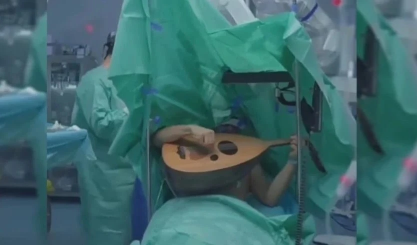 Paciente toca el laúd mientras le operan el cerebro en Irak. Foto: Hospital Internacional Al-Hayat.