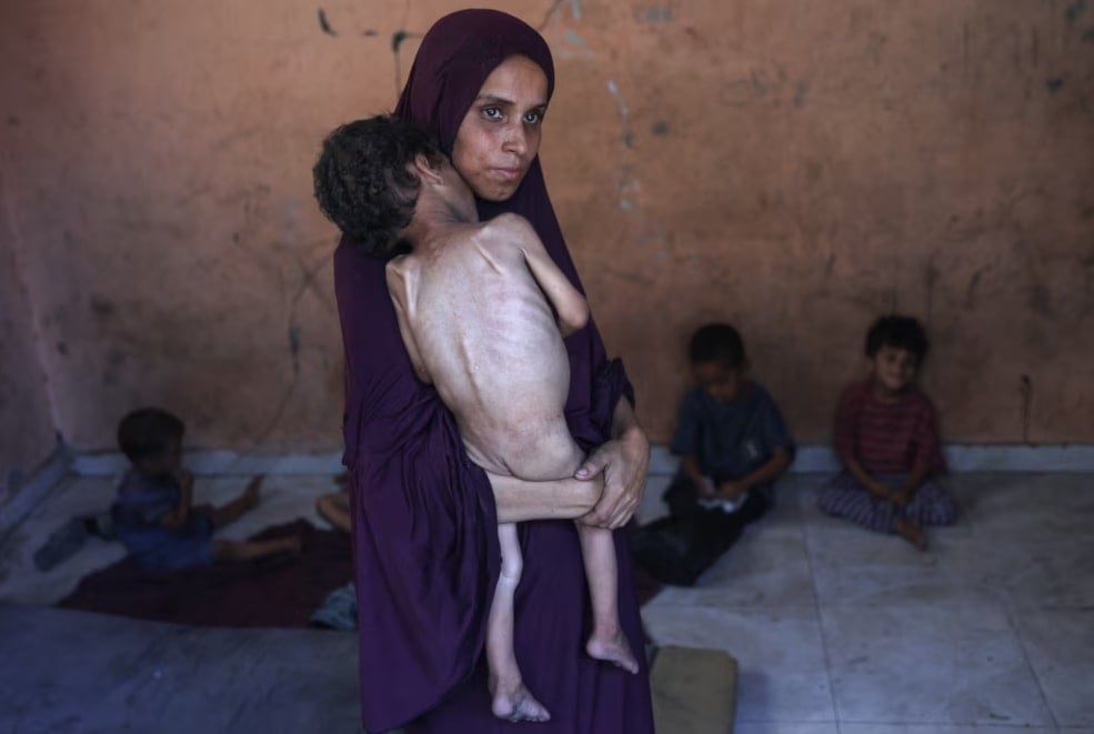 Naeema, una madre palestina de 30 años, sostiene a su hijo Yazan, de dos años, quien padece desnutrición en el campo de refugiados de Al-Shati (Foto: AFP)