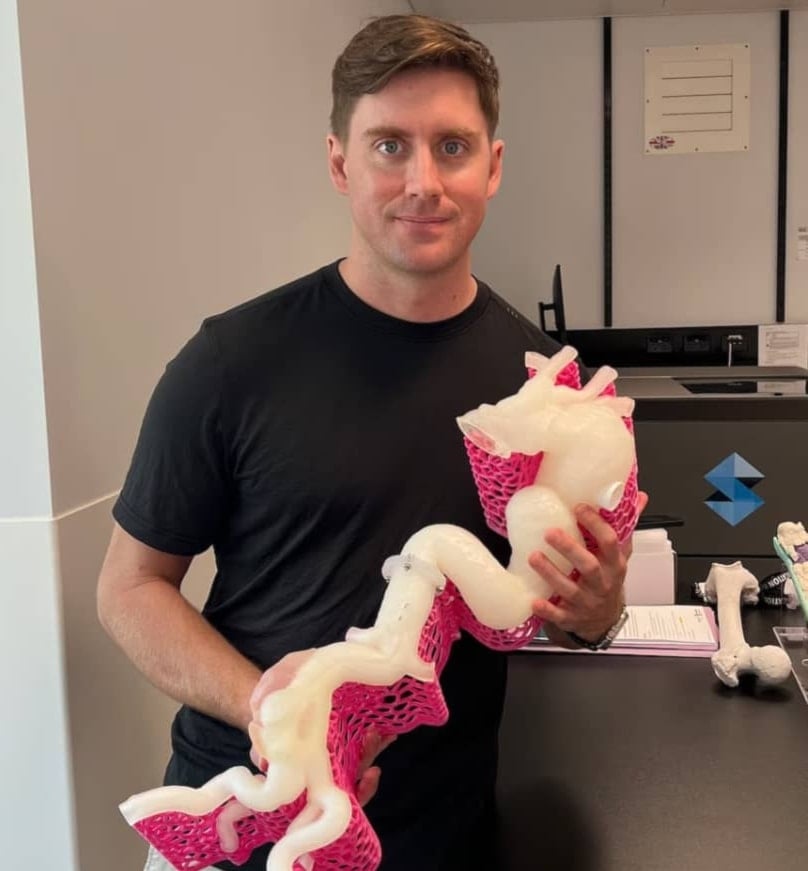 Los cirujanos utilizaron la maqueta a tamaño real para planificar mejor la intervención. Foto: Queensland Health.