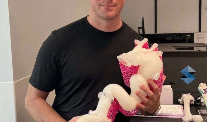 Los cirujanos utilizaron la maqueta a tamaño real para planificar mejor la intervención. Foto: Queensland Health.