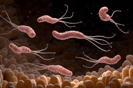 Identifican la causa del aumento de cáncer gástrico en jóvenes. Foto: Getty Images. 