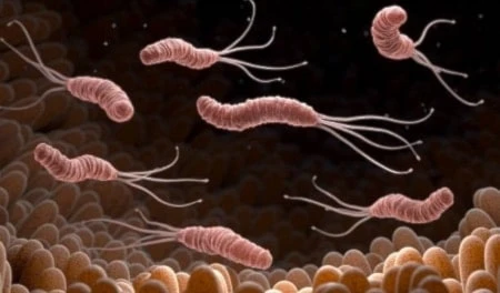 Identifican la causa del aumento de cáncer gástrico en jóvenes. Foto: Getty Images.