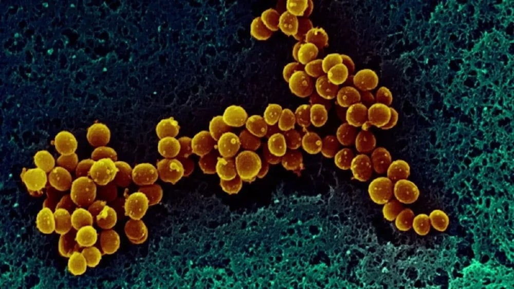 Descubren diana terapéutica en microbios antiguos