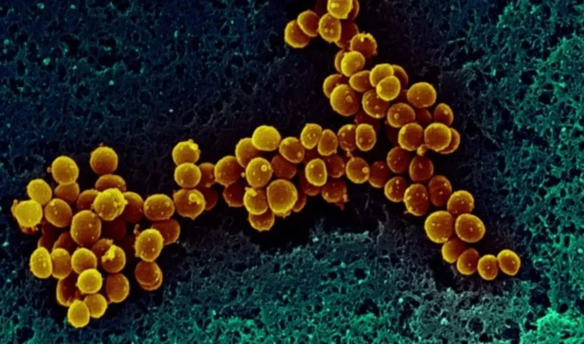 Descubren diana terapéutica en microbios antiguos Descubren diana terapéutica en microbios antiguos