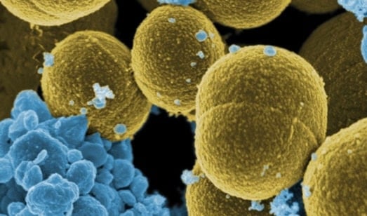 El impétigo bulloso casi siempre es causado por Staphylococcus aureus