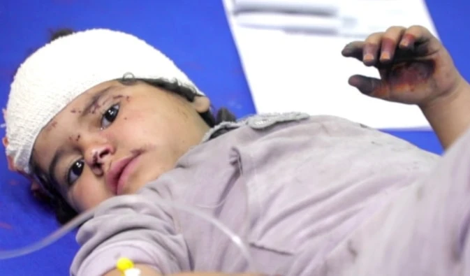 Médicos en Gaza reportan patrón perturbador de niños tiroteados